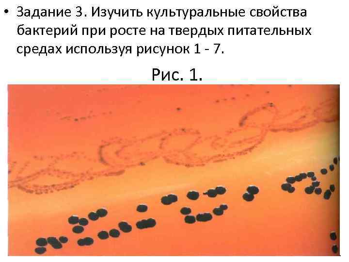 • Задание 3. Изучить культуральные свойства бактерий при росте на твердых питательных средах