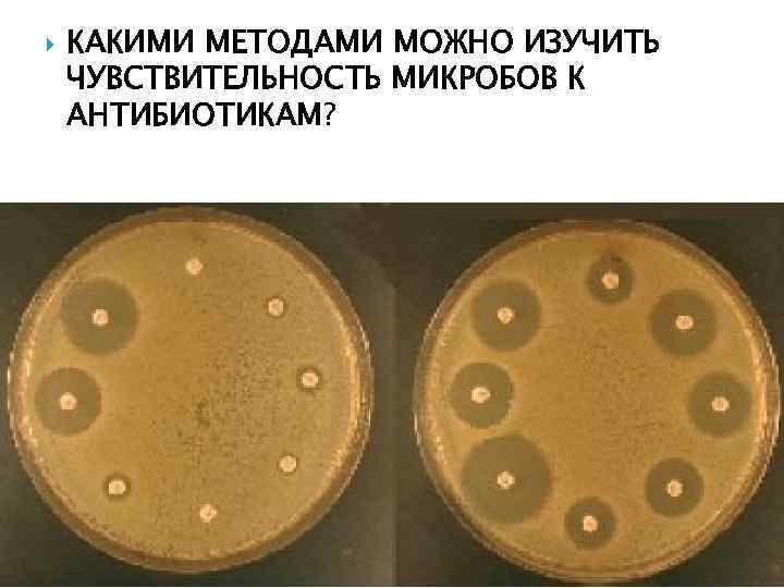  КАКИМИ МЕТОДАМИ МОЖНО ИЗУЧИТЬ ЧУВСТВИТЕЛЬНОСТЬ МИКРОБОВ К АНТИБИОТИКАМ? 