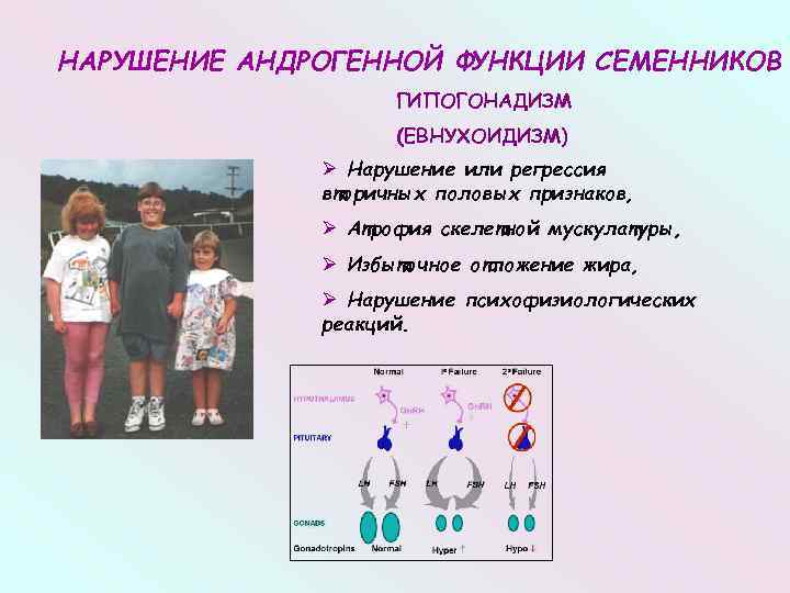 Синдром бидля муна. Евнухоидный Тип телосложения. Синдром Клайнфельтера гипогонадизм. Евнухоидный Тип ожирения. Синдром Клайнфельтера евнухоидное.