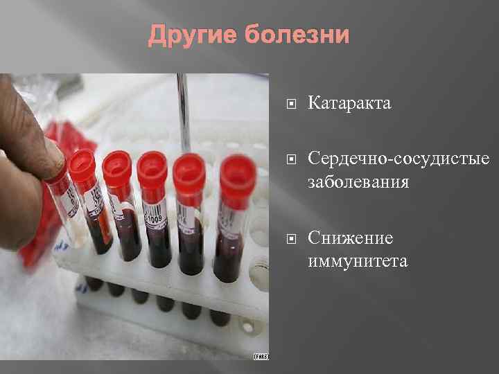Другие болезни Катаракта Сердечно-сосудистые заболевания Снижение иммунитета 