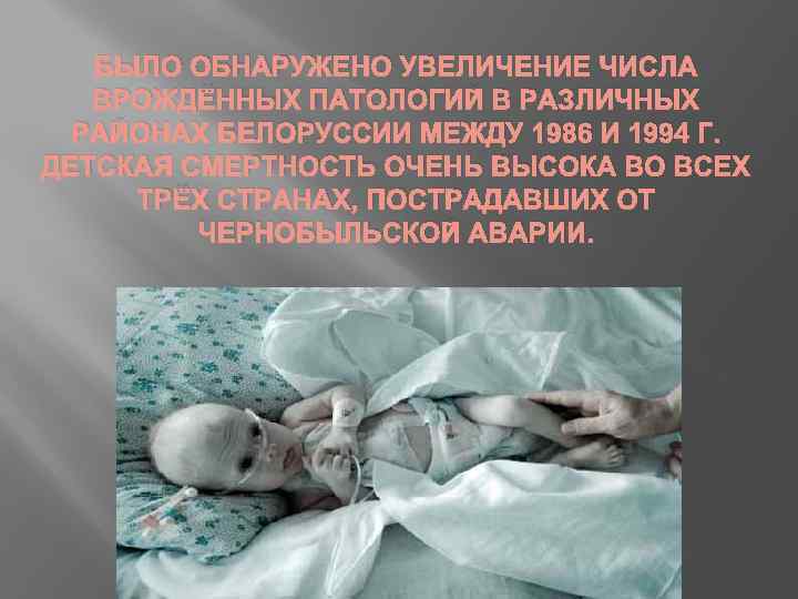 БЫЛО ОБНАРУЖЕНО УВЕЛИЧЕНИЕ ЧИСЛА ВРОЖДЁННЫХ ПАТОЛОГИЙ В РАЗЛИЧНЫХ РАЙОНАХ БЕЛОРУССИИ МЕЖДУ 1986 И 1994