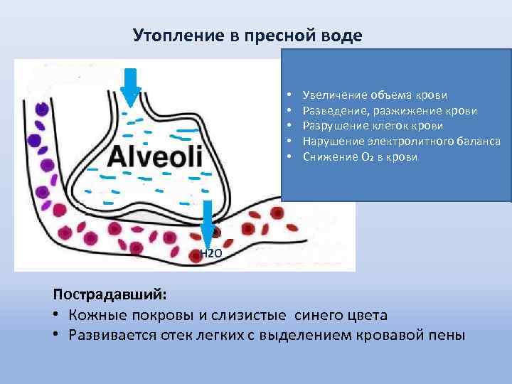 Утопление в пресной воде • • • Увеличение объема крови Разведение, разжижение крови Разрушение