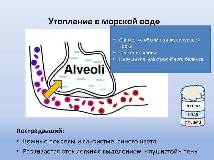 Бледное утопление картинки