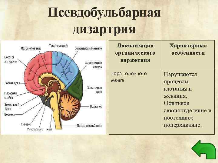 Псевдобульбарная дизартрия Локализация органического поражения кора головного мозга Характерные особенности Нарушаются процессы глотания и