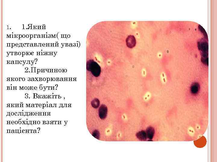 1. 1. Який мікроорганізм( що представлений увазі) утворює ніжну капсулу? 2. Причиною якого захворювання