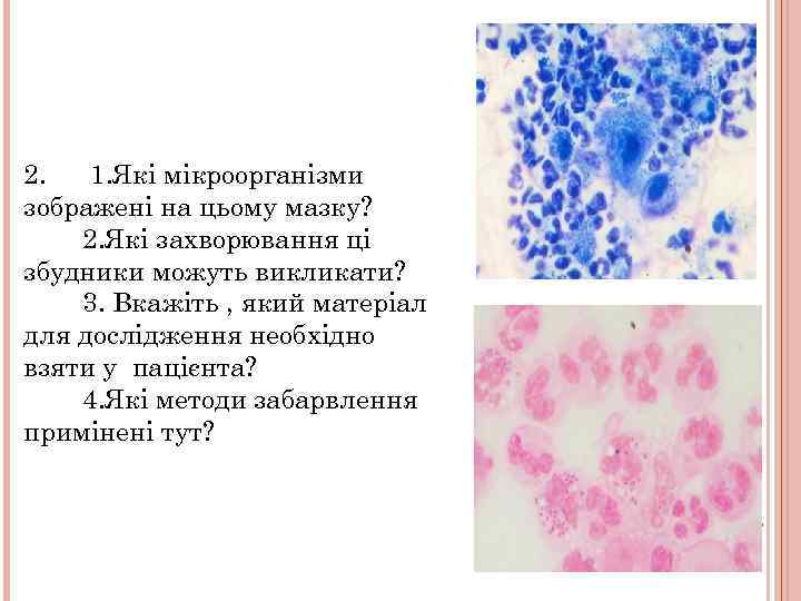 2. 1. Які мікроорганізми зображені на цьому мазку? 2. Які захворювання ці збудники можуть