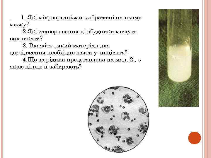 . 1. Які мікроорганізми зображені на цьому мазку? 2. Які захворювання ці збудники можуть