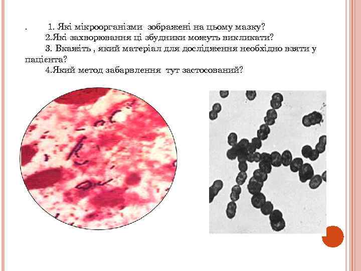 . 1. Які мікроорганізми зображені на цьому мазку? 2. Які захворювання ці збудники можуть