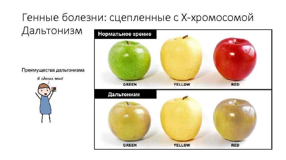 Дальтонизм и нормальное зрение. Дальтонизм наследственное заболевание. Дальтонизм это генная болезнь. Нормальное зрение и дальтонизм. Типы дальтоников.