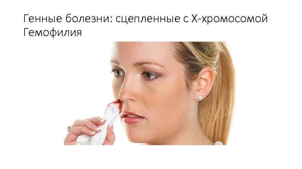 Генные болезни: сцепленные с Х-хромосомой Гемофилия 