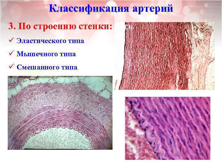 Классификация артерий 3. По строению стенки: ü Эластического типа ü Мышечного типа ü Смешанного