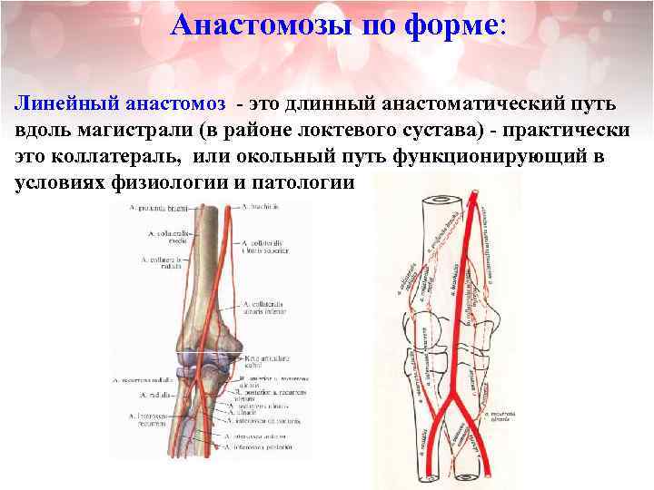 Анастомозы по форме: Линейный анастомоз - это длинный анастоматический путь вдоль магистрали (в районе