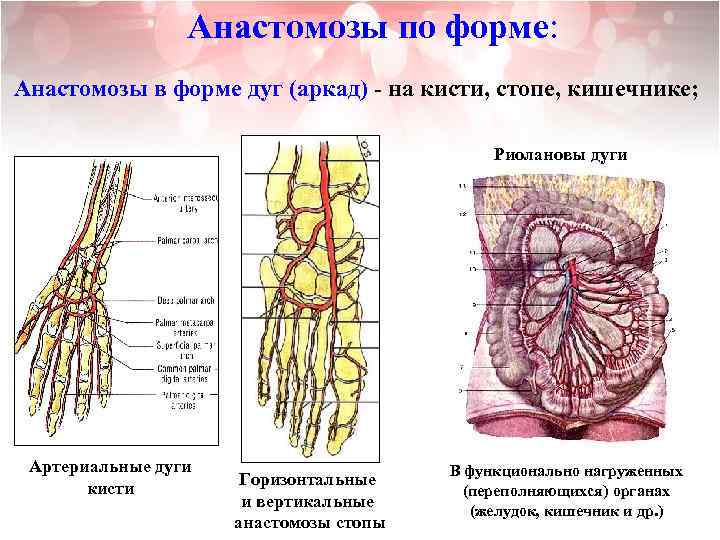 Анастомоз по брауну схема