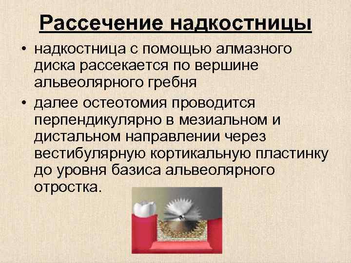 Рассечение надкостницы • надкостница с помощью алмазного диска рассекается по вершине альвеолярного гребня •