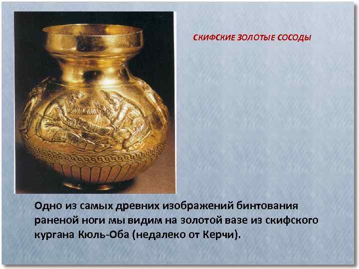 СКИФСКИЕ ЗОЛОТЫЕ СОСОДЫ Одно из самых древних изображений бинтования раненой ноги мы видим на