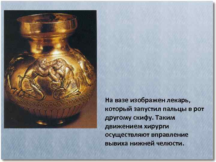 На вазе изображен лекарь, который запустил пальцы в рот другому скифу. Таким движением хирурги