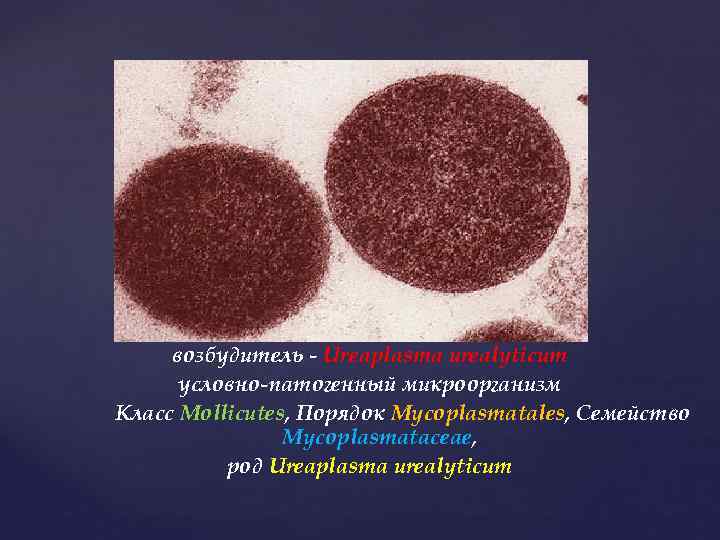 возбудитель - Ureaplasma urealyticum условно-патогенный микроорганизм Класс Mollicutes, Порядок Mycoplasmatales, Семейство Mycoplasmataceae, род Ureaplasma