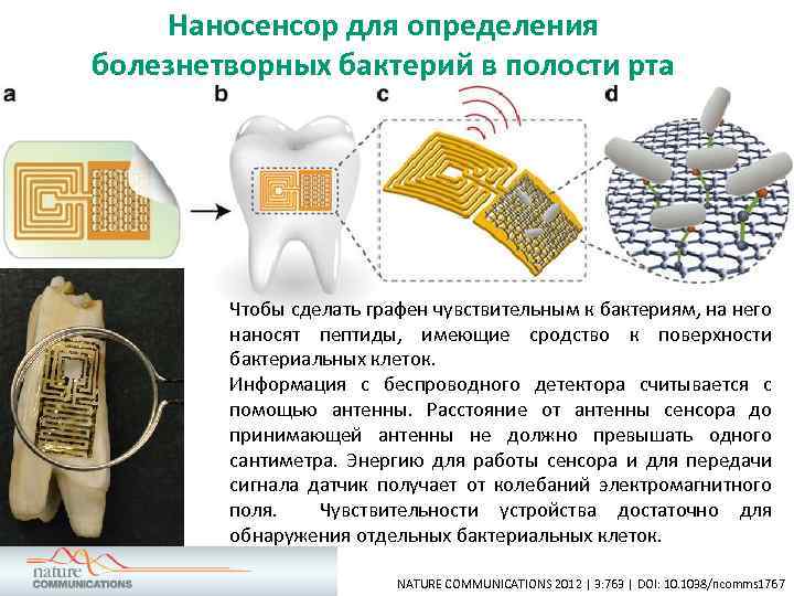 Наносенсор для определения болезнетворных бактерий в полости рта Чтобы сделать графен чувствительным к бактериям,