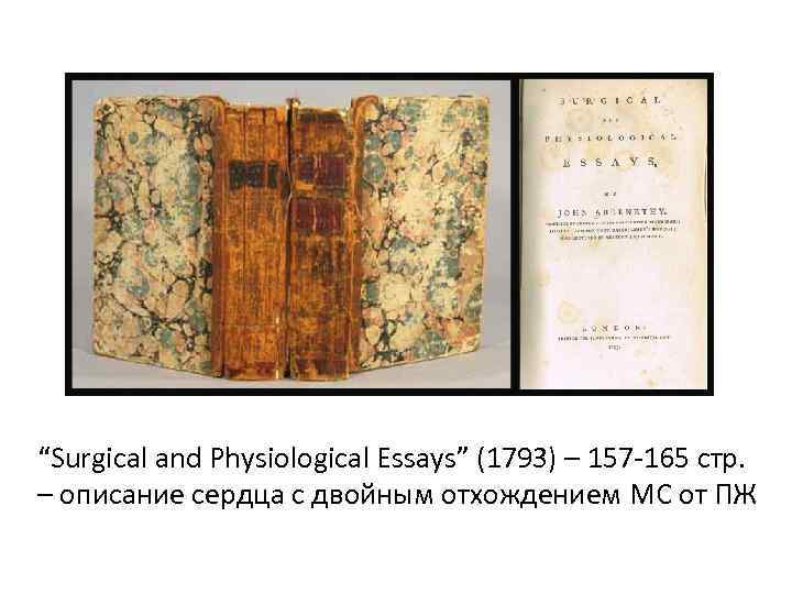 “Surgical and Physiological Essays” (1793) – 157‐ 165 стр. – описание сердца с двойным