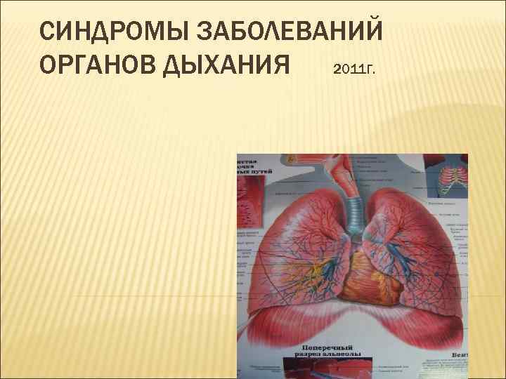СИНДРОМЫ ЗАБОЛЕВАНИЙ ОРГАНОВ ДЫХАНИЯ 2011 Г. 