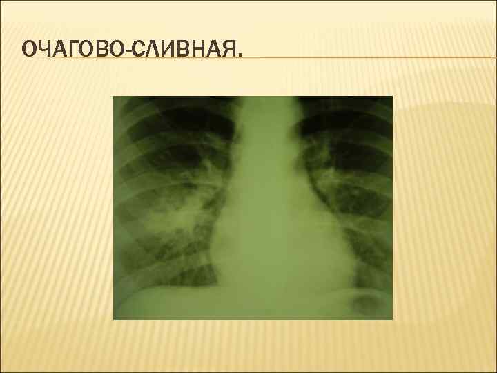 ОЧАГОВО-СЛИВНАЯ. 