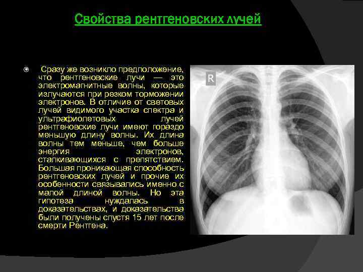 Свойства рентгеновских лучей Сразу же возникло предположение, что рентгеновские лучи — это электромагнитные волны,