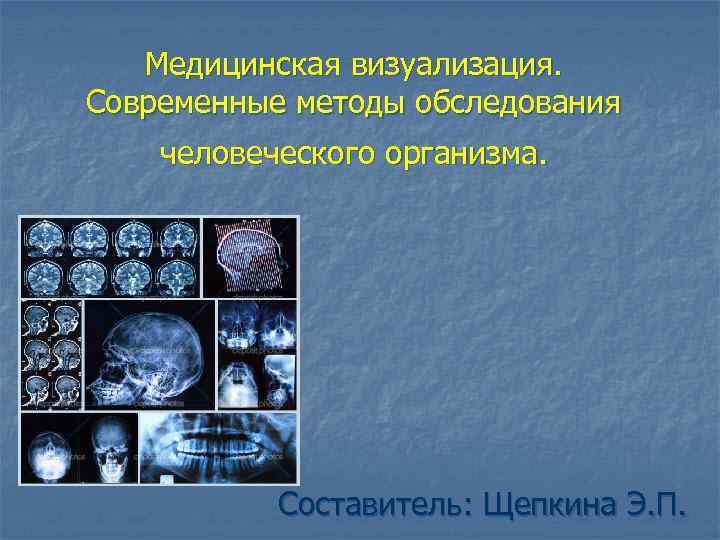 Медицинская визуализация. Современные методы обследования человеческого организма. Составитель: Щепкина Э. П. 