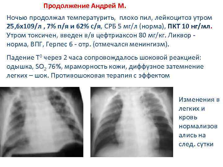 Продолжение Андрей М. Ночью продолжал температурить, плохо пил, лейкоцитоз утром 25, 6 х109/л ,