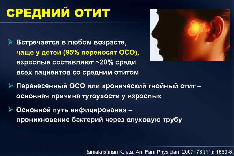 СРЕДНИЙ ОТИТ Ø Встречается в любом возрасте, чаще у детей (95% переносят ОСО), взрослые