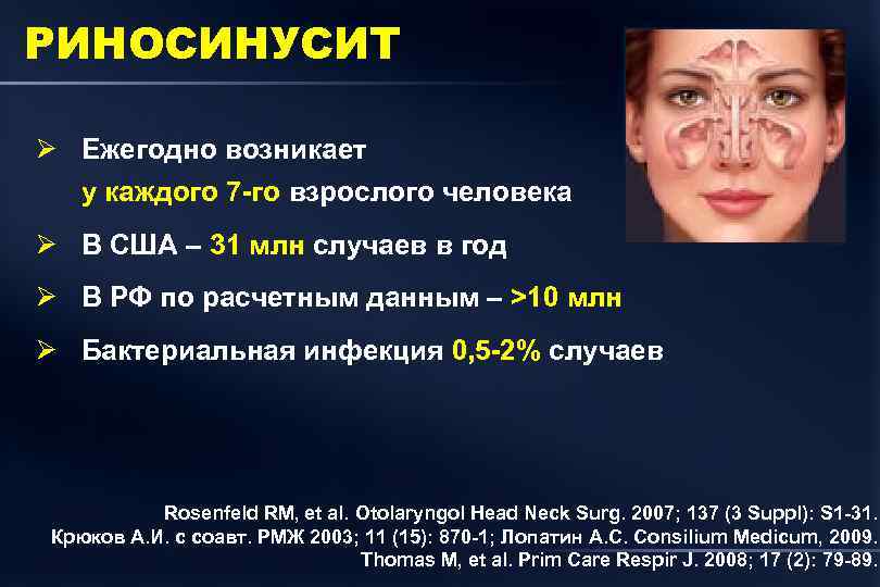 РИНОСИНУСИТ Ø Ежегодно возникает у каждого 7 -го взрослого человека Ø В США –