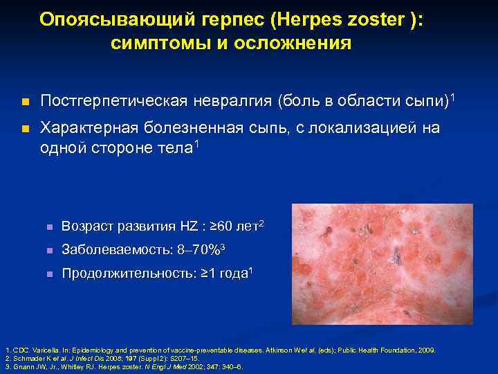 Опоясывающий герпес (Herpes zoster ): симптомы и осложнения n Постгерпетическая невралгия (боль в области