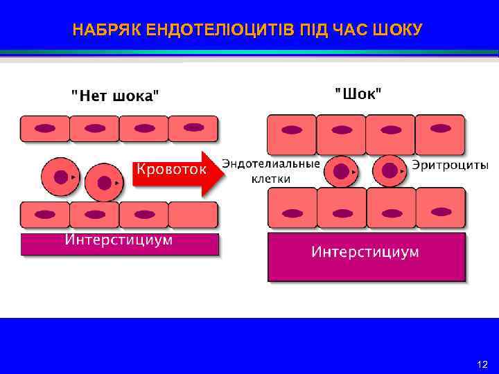 НАБРЯК ЕНДОТЕЛІОЦИТІВ ПІД ЧАС ШОКУ 12 