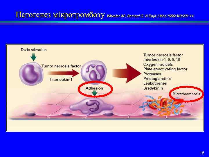 Патогенез мікротромбозу Wheeler AP, Bernard G. N Engl J Med 1999; 340: 207 -14