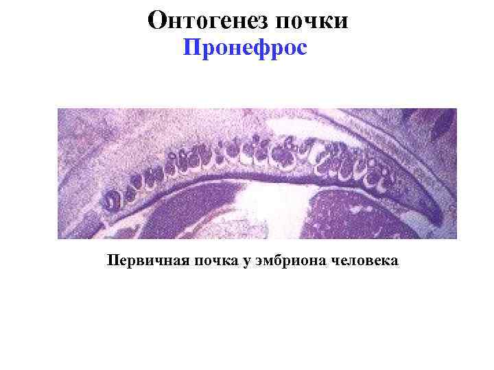 Онтогенез почки Пронефрос Первичная почка у эмбриона человека 