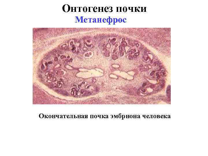 Онтогенез почки Метанефрос Окончательная почка эмбриона человека 