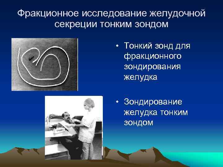 Фракционное исследование желудочной секреции тонким зондом • Тонкий зонд для фракционного зондирования желудка •