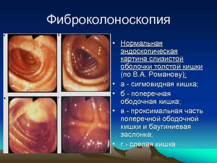 Фиброколоноскопия • Нормальная эндоскопическая картина слизистой оболочки толстой кишки (по В. А. Романову): •