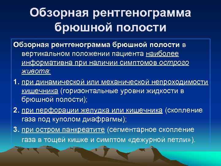 Обзорная рентгенограмма брюшной полости в вертикальном положении пациента наиболее информативна при наличии симптомов острого