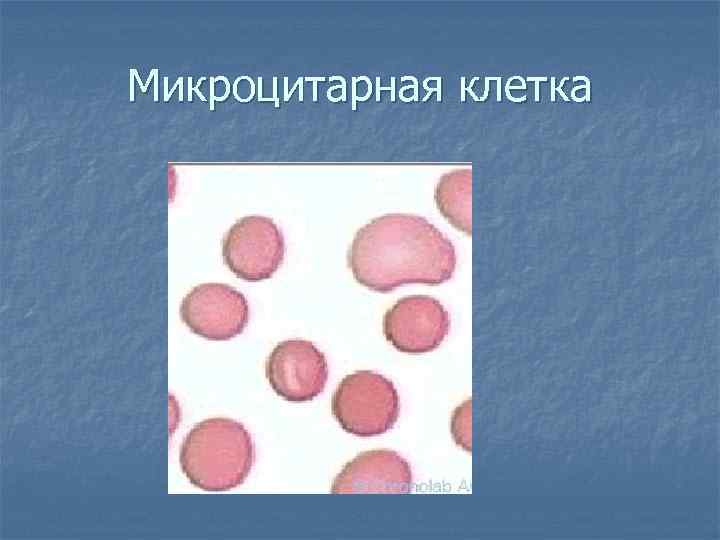 Микроцитарная клетка 