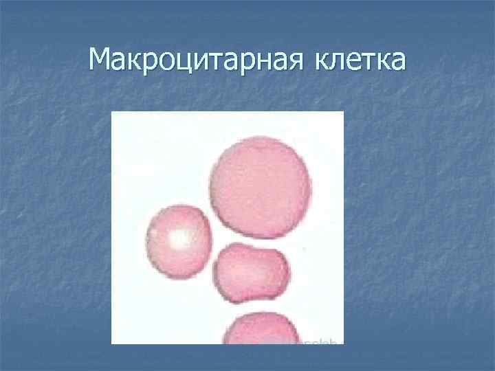 Макроцитарная клетка 