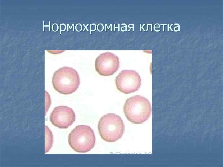 Нормохромная клетка 