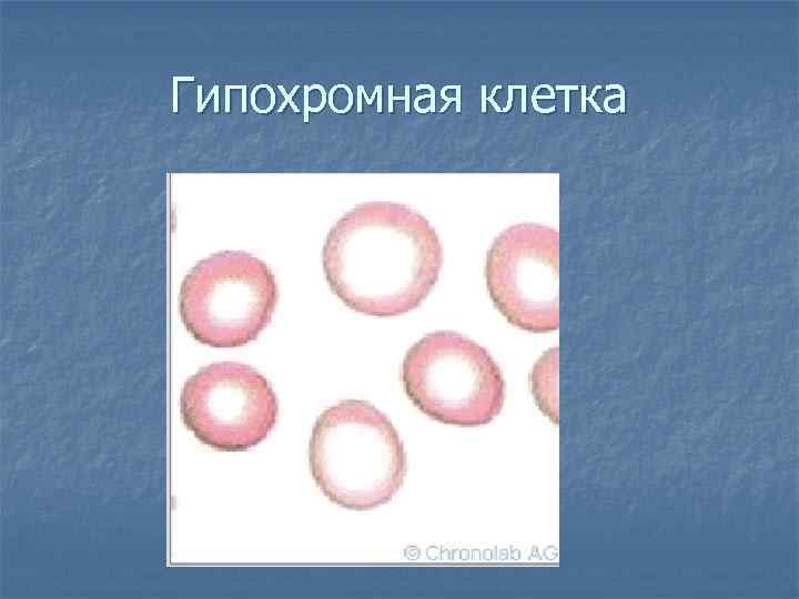 Гипохромная клетка 
