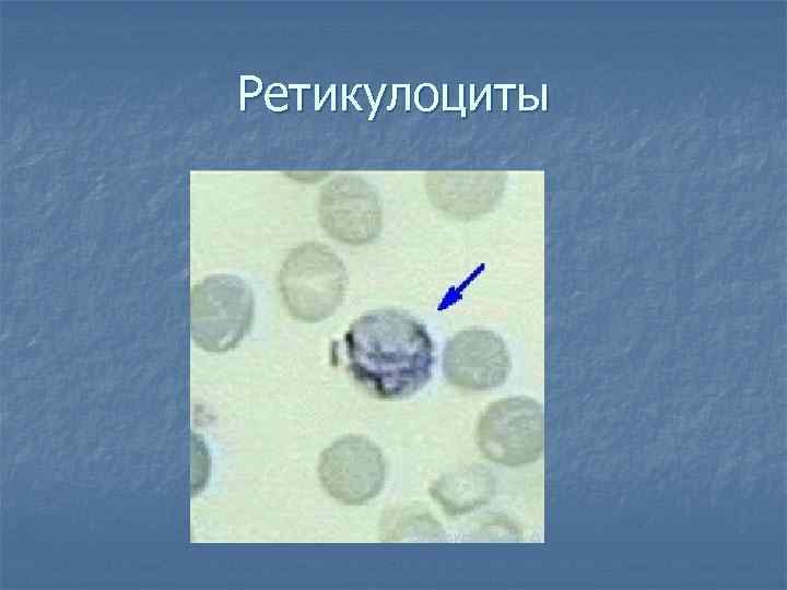Ретикулоциты 