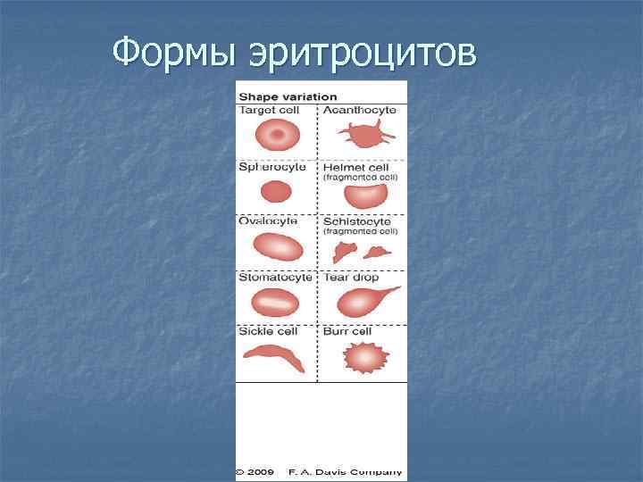 Формы эритроцитов 