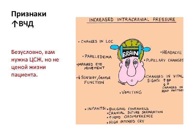 Признаки ↑ВЧД Безусловно, вам нужна ЦСЖ, но не ценой жизни пациента. 