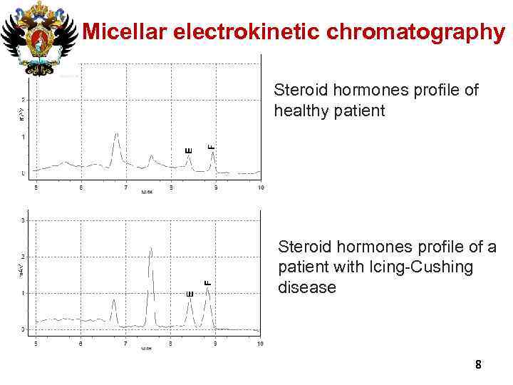 Micellar electrokinetic chromatography Steroid hormones profile of healthy patient Steroid hormones profile of a