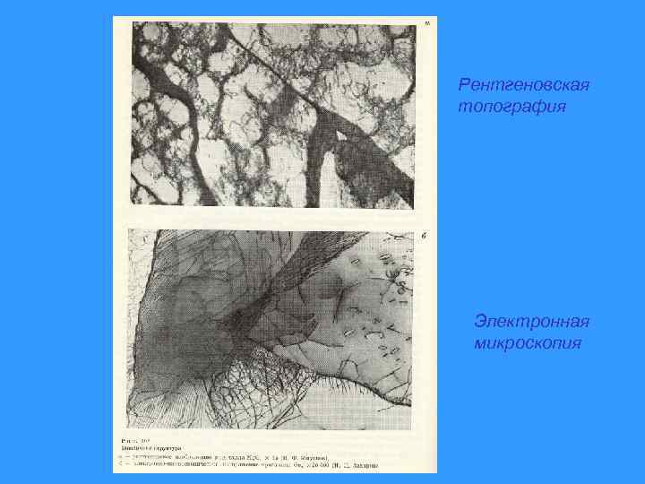 Рентгеновская топография Электронная микроскопия 