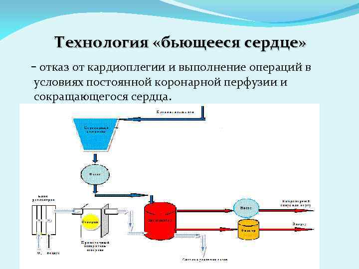 Технология «бьющееся сердце» - отказ от кардиоплегии и выполнение операций в условиях постоянной коронарной