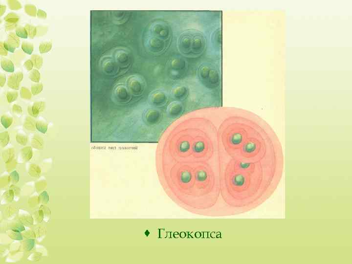 · Глеокопса 