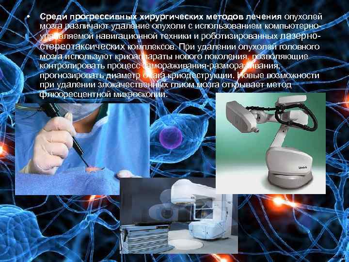  • Среди прогрессивных хирургических методов лечения опухолей мозга различают удаление опухоли с использованием